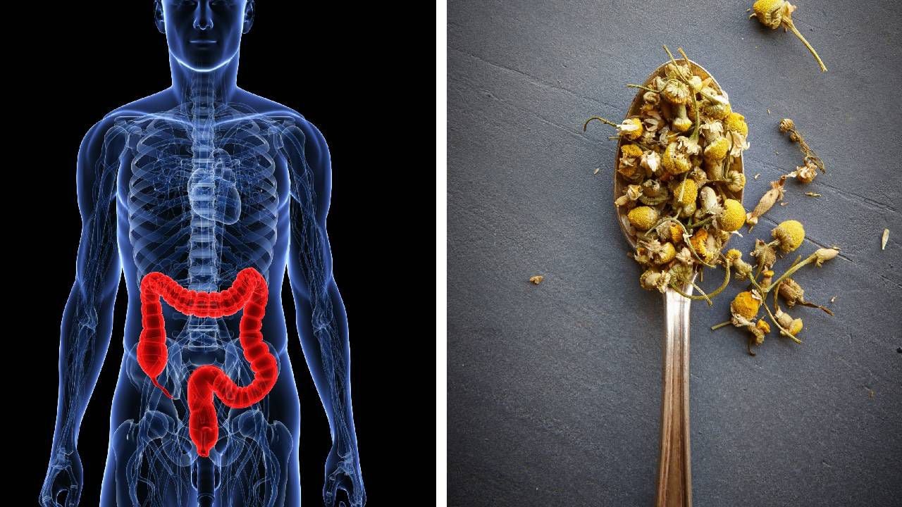 Una molestia como el colon irritable se puede tratar con remedios naturales. Foto: Getty Images. Montaje SEMANA.