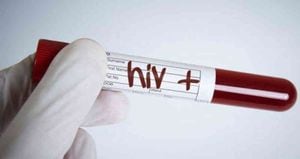 ¿Cómo una mujer se curó de VIH sin medicamentos en Europa?