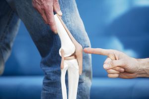 Los tendones y ligamentos de la rodilla se complementan entre sí. Getty Images.