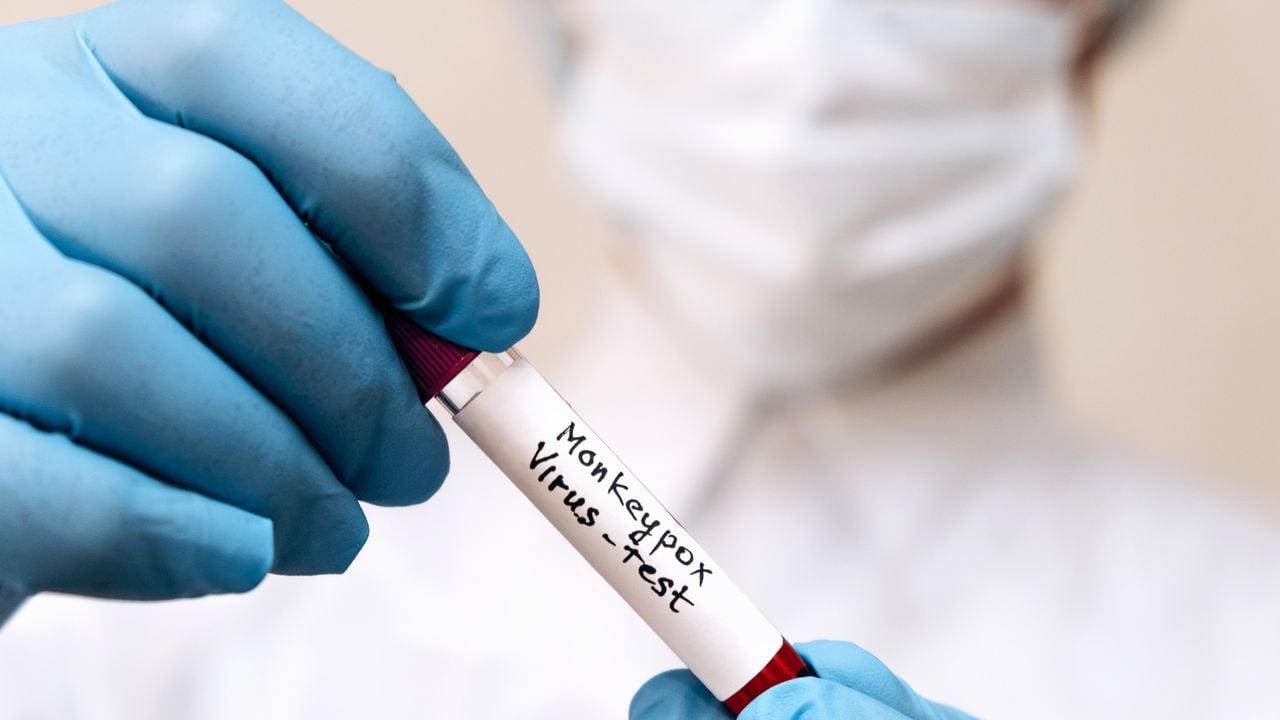 Un trabajador médico sostiene un tubo de ensayo con una muestra de sangre infectada con el virus de la viruela del mono en sus manos