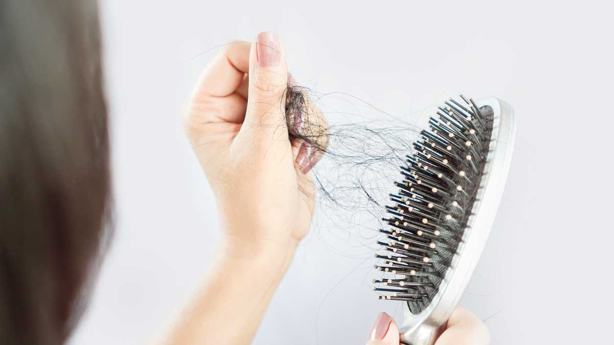 La pérdida de cabello puede ser causada por múltiples causas.
