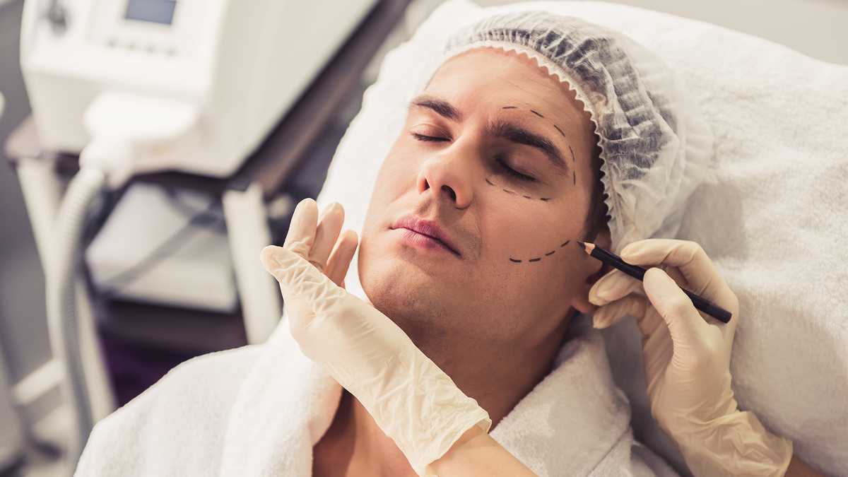 Las cirugías más comunes que se hacen los hombres son mentón, nariz, cuello y orejas.