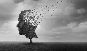 La enfermedad de Alzheimer como una pérdida de memoria neuropatológica debida a la degeneración y el declive del cerebro como un concepto de enfermedad neurológica médica surrealista.