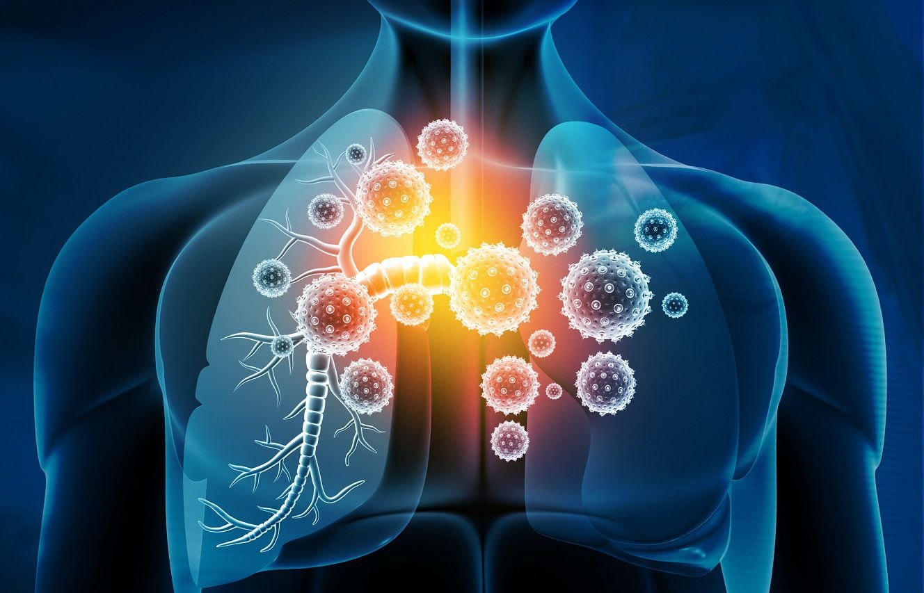 bronchial and lung infections