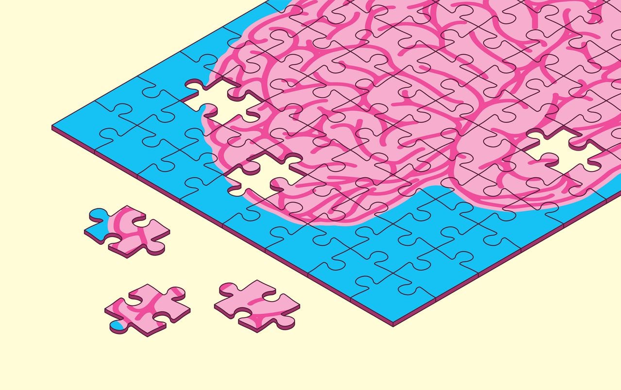 Human brain puzzle pieces with few missing pieces. Memory loss, Alzheimer's, Brain damage, Dementia,  Intelligence, Learning disability, Mind games, leisure games concept vector illustration.