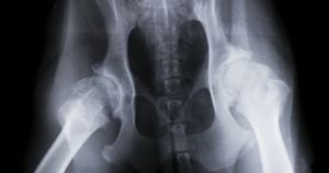 La displasia de cadera, también llamada displasia coxofemoral, es el desarrollo anormal de la unión que hay entre la cabeza del fémur y la cavidad de la cadera donde encaja (acetábulo).