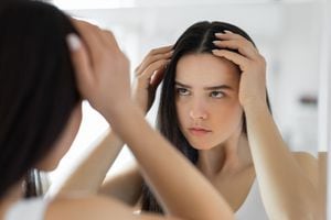 Woman having problem with hair loss