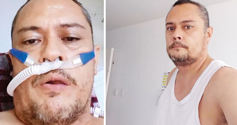 Jorge Otálora permaneció 21 días en una uci por culpa de la covid. Durante la hospitalización perdió 20 kilos.