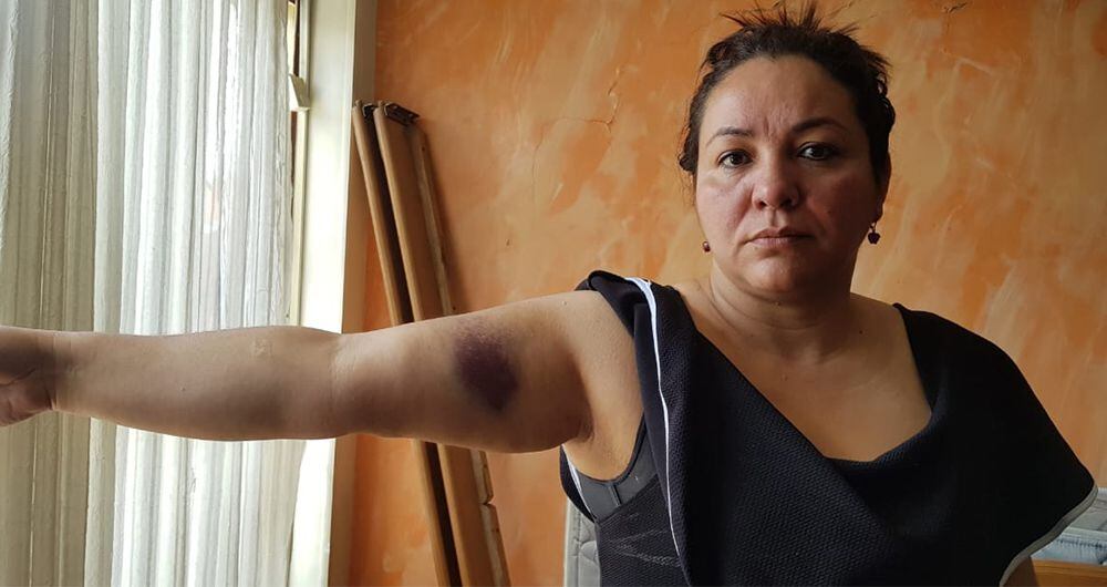 Rosa Talero recibió múltiples golpes por parte de dos agresores desconocidos, quienes le dijeron "Calladita se ve mejor". Resultó con hematomas en brazos y cadera.