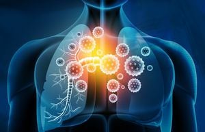 Los bronquios son clave para suministrar aire a los pulmones.