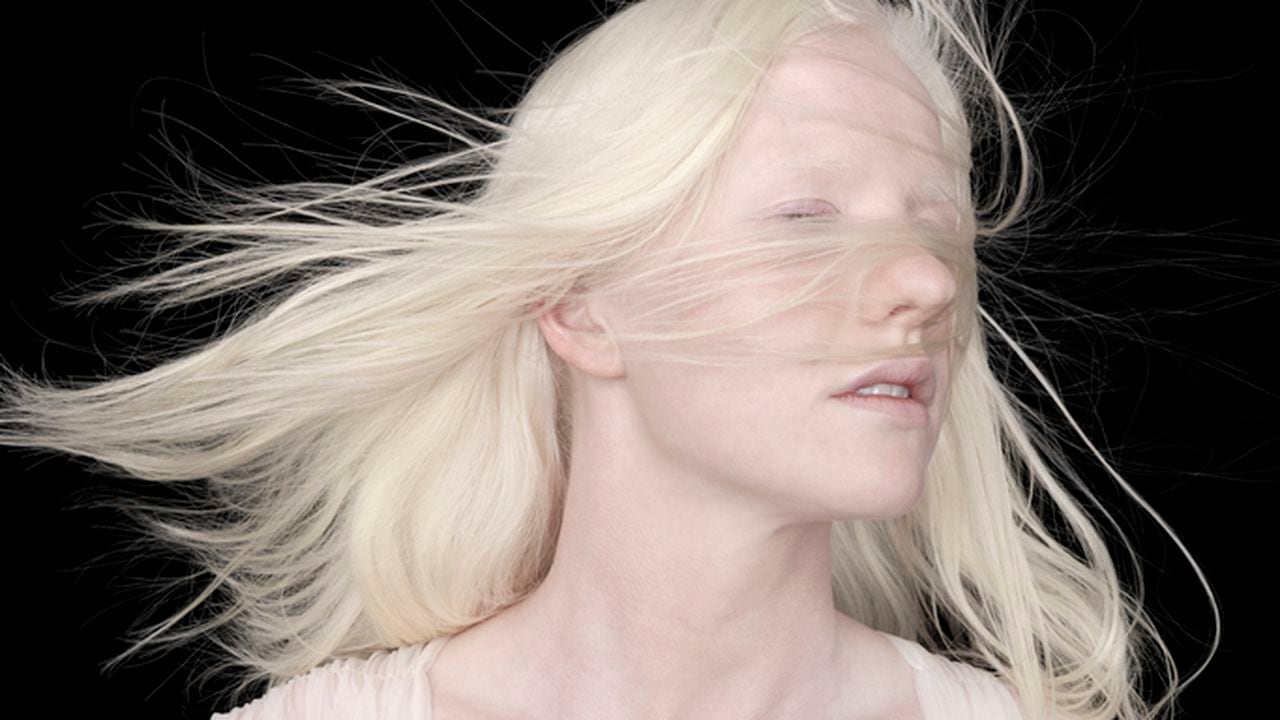 Mujer albina