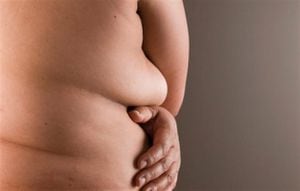 Contra la obesidad: convertir la grasa mala en buena, foto: Thinkstock