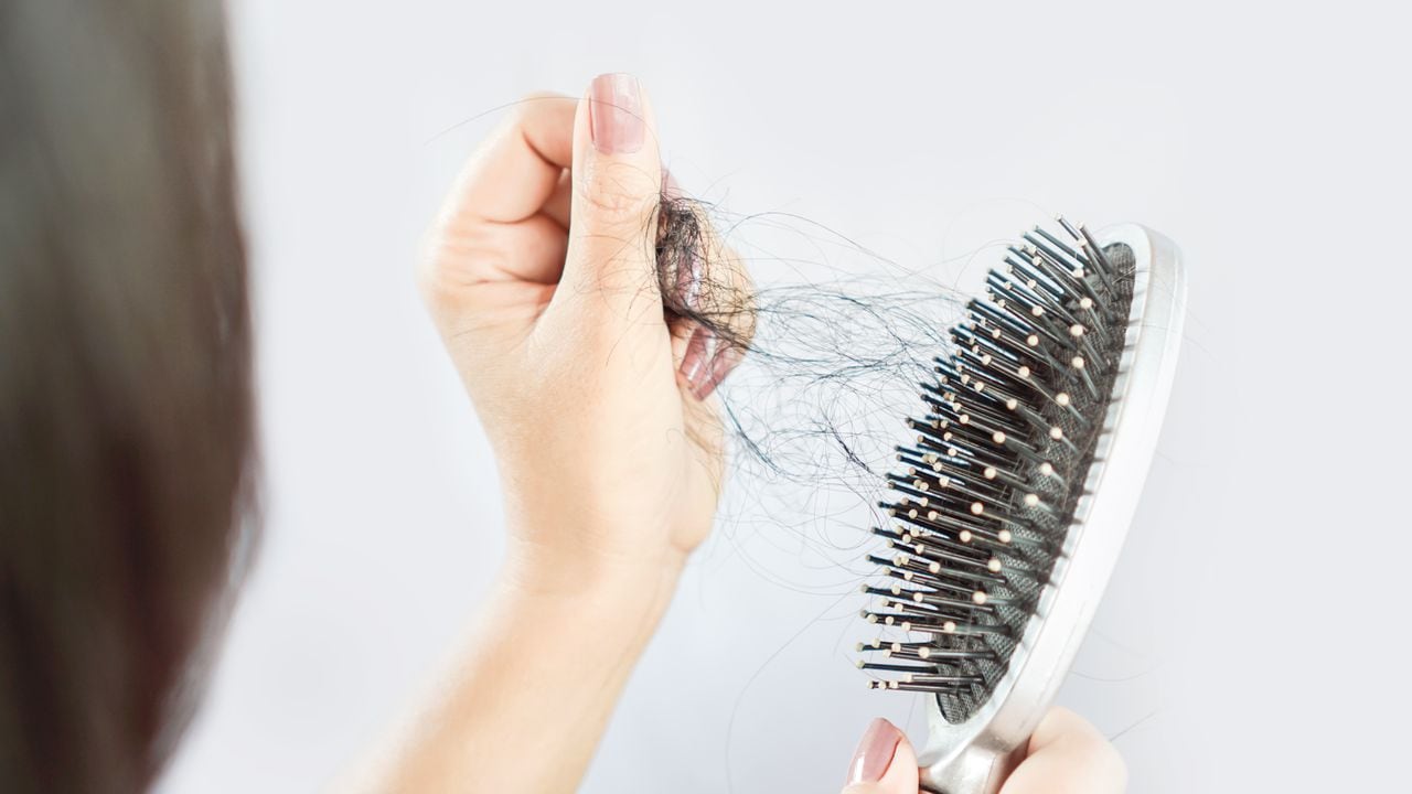 Esta afección puede generar a que el cabello comience a deteriorarse.