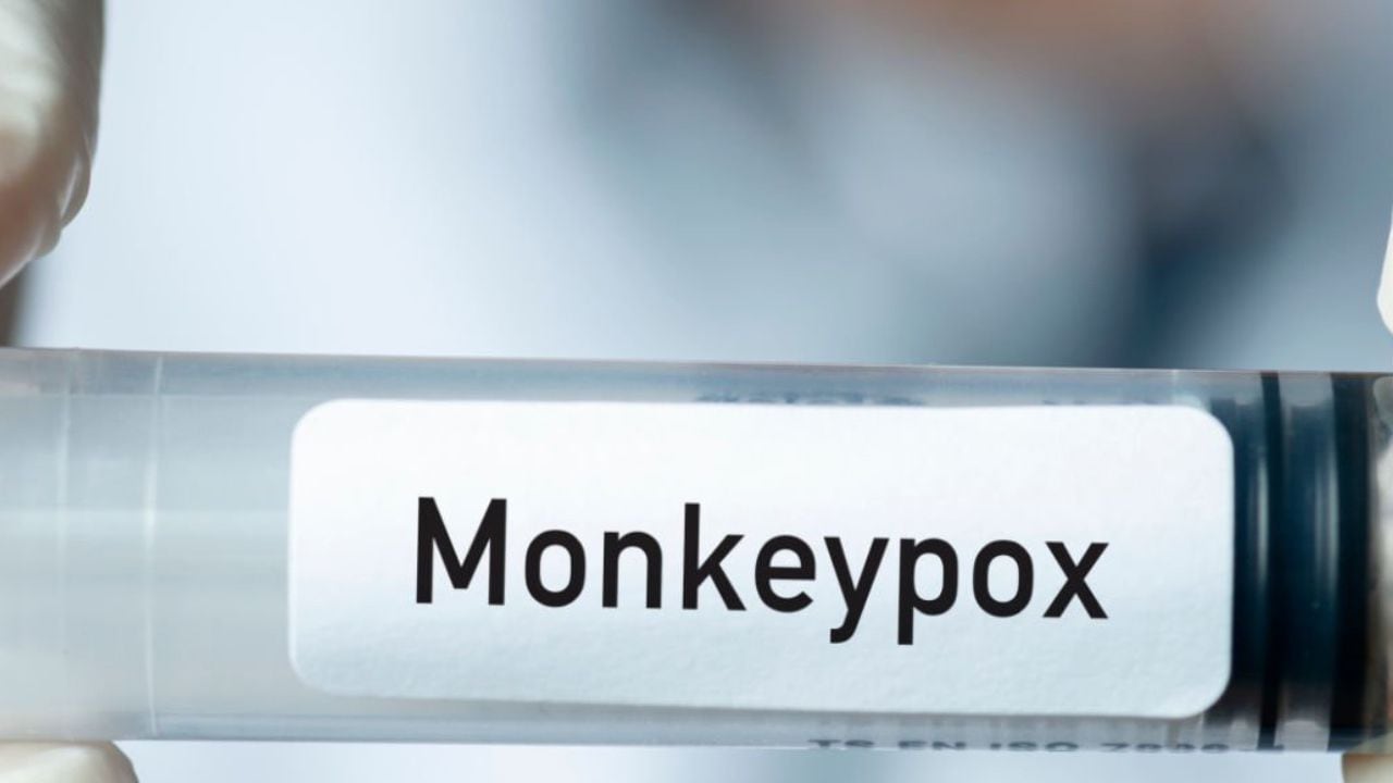 La viruela del mono está siendo detectada en varios países del mundo