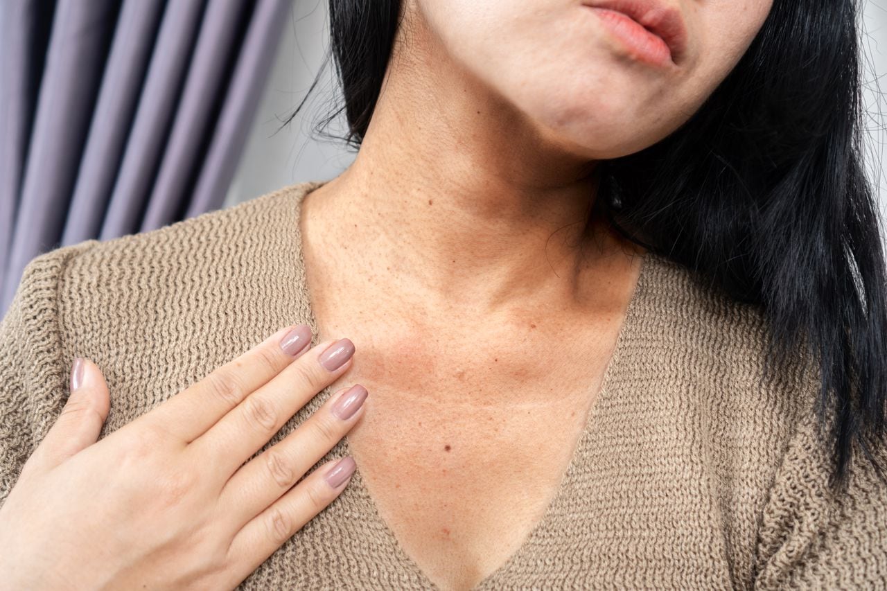 Muchos son los remedios caseros que pueden aclarar la piel del cuello.