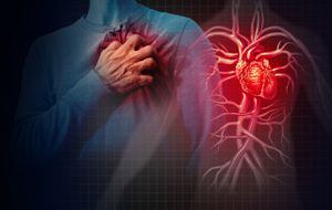 De acuerdo con médicos especialistas en cardiología, lo que la gente denomina preinfarto o infarto, es un dolor en el pecho o angina, que cuando se presenta debe ser atendido de inmediato para descartar cualquier riesgo de daño o muerte del músculo cardiaco. Aunque lo más recomendable es consultar mucho antes, cuando se presenten las primeras señales de riesgo.