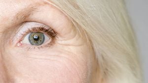 Con remedios caseros se pueden eliminar las arrugas en los ojos sin tener que comprar costosas cremas. Foto: GettyImages.