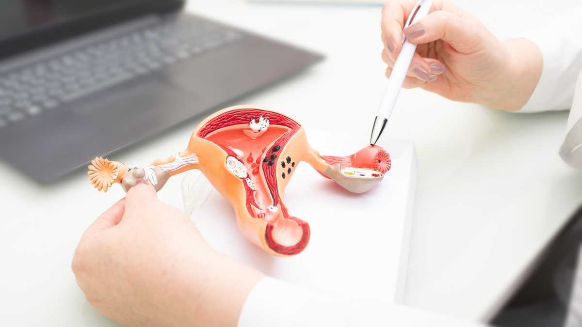 Gynecologist showing uterine structure on a uterus model. Uterus model on gynecologist's desk close-up