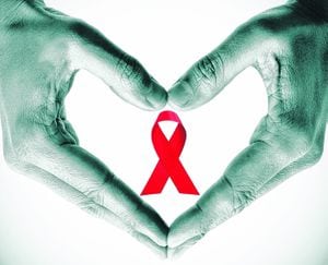 Una de las  principales recomendaciones para prevenir el VIH es el uso del condón. Asimismo, realizar acuerdos con las parejas sobre la sexualidad. Es importante, además, hacer exámenes con regularidad.