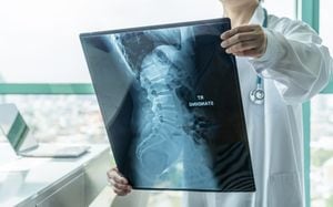 Doctor quirúrgico que mira la película de rayos X de la espina radiológica para el diagnóstico médico en la salud del paciente en la enfermedad de la columna vertebral, enfermedad del cáncer de hueso, atrofia muscular espinal, concepto de salud médica