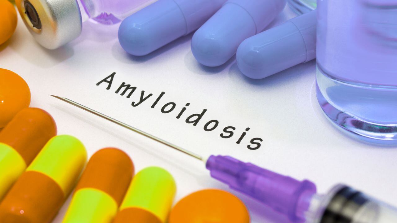 amiloidosis