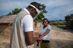 Theopiste Maloko, de 42 años, funcionario de salud local, revisa las lesiones en los brazos de una mujer que sufre de viruela del mono y recientemente perdió un hijo por la misma enfermedad, en Yalokombe, Tshopo, República Democrática del Congo, 4 de octubre de 2022. 