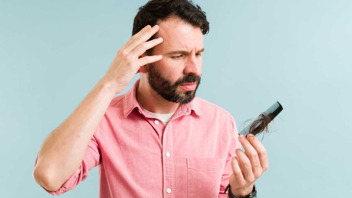 La pérdida de pelo puede estar relacionada con un déficit en la alimentación.Pérdida de pelo por falta de vitaminas