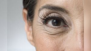 Las arrugas en los ojos pueden ser tratadas con remedios naturales como el aguacate, uvas verdes y la clara de huevo. Foto: GettyImages.