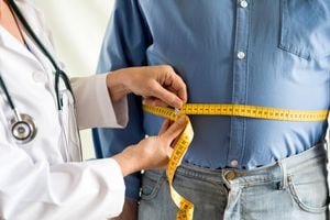 Exceso de peso sobrepeso medico