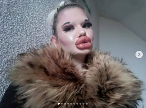 Andrea Ivanova quiere labios y pómulos más grandes, pese a que los médicos le han advertido de los peligros.