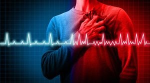 Arritmia cardiaca - Imagen de referencia