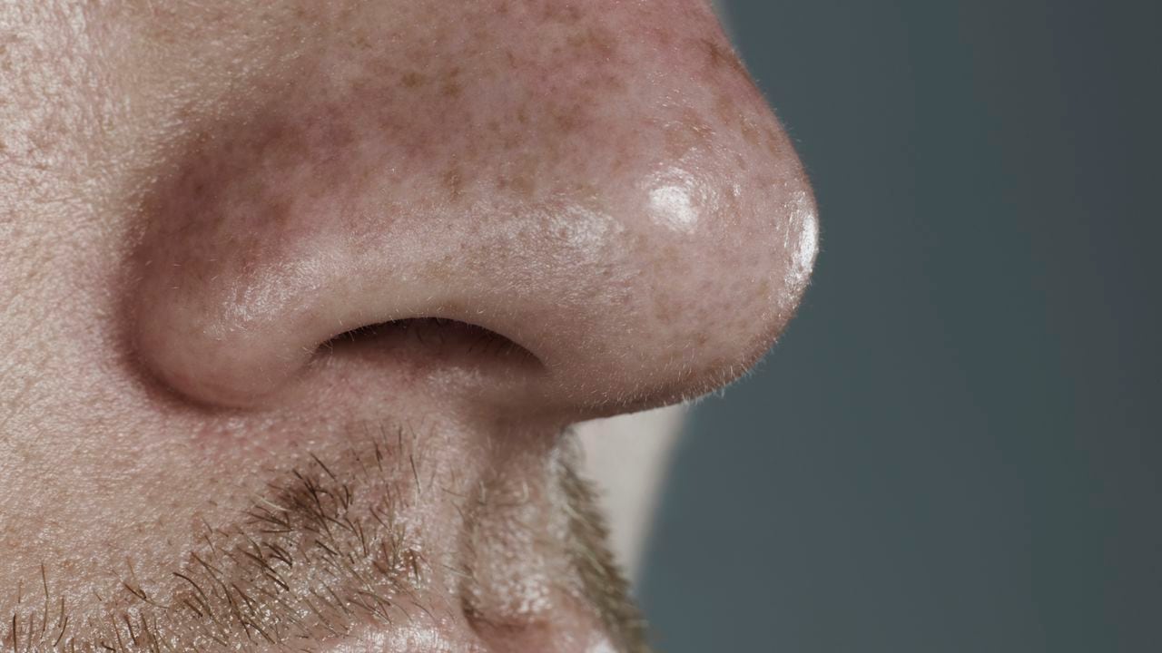 ¿Por qué sangra la nariz y cuando es motivo de preocupación?