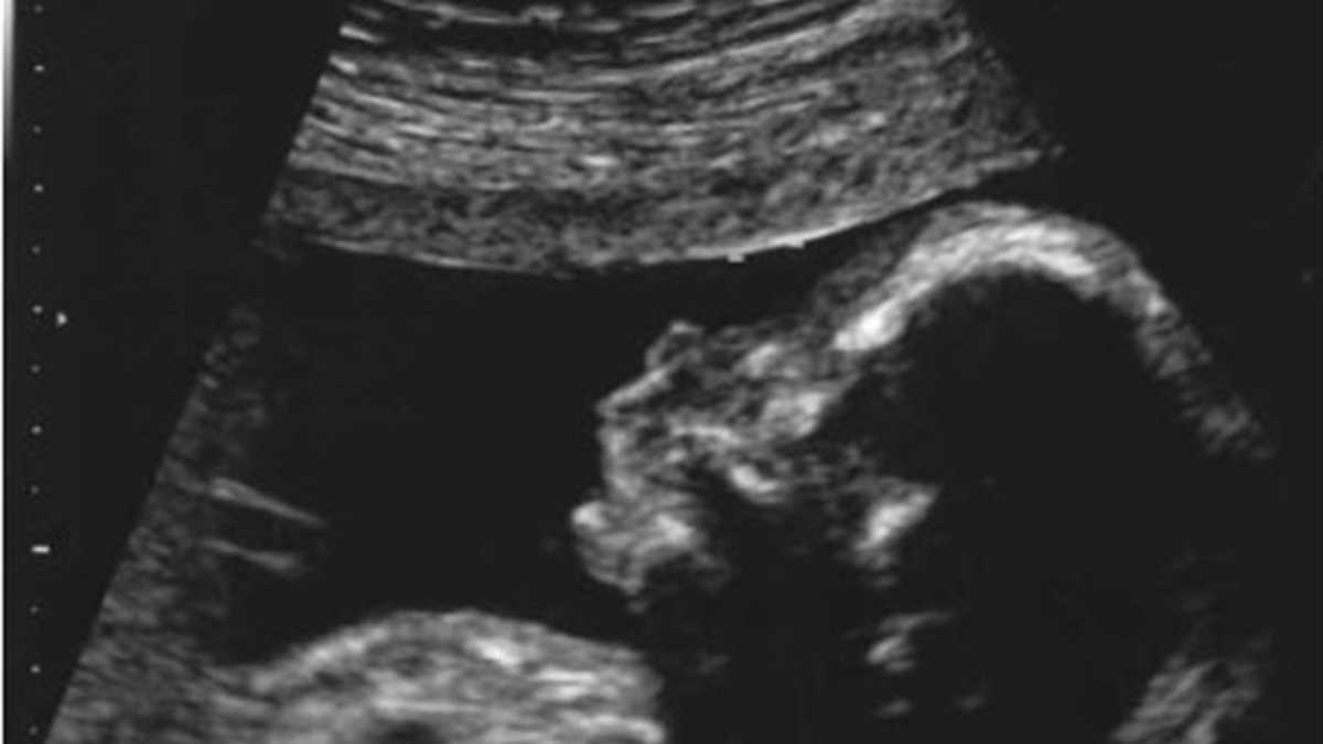 Cuando te realizan una ecografía, el médico puede visualizar a tu bebé en su ambiente intrauterino.