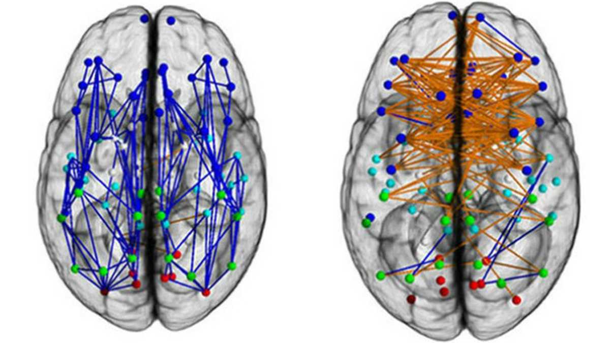 Las estructuras cerebrales en las que se centraron los investigadores se comparten entre los mamíferos, incluidos los humanos.