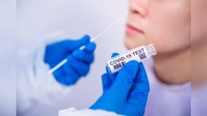 Las pruebas antígeno para detectar la covid-19 se podrán adquirir en droguerías o establecimientos de confianza del país.