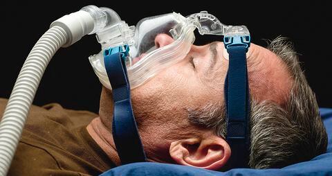  La apnea es una obstrucción derivada de la anatomía del cuello o de la obesidad, que se resuelve con el APPC, pues inyecta aire a presión. Con esa sencilla solución, se reduce el riesgo de demencia.