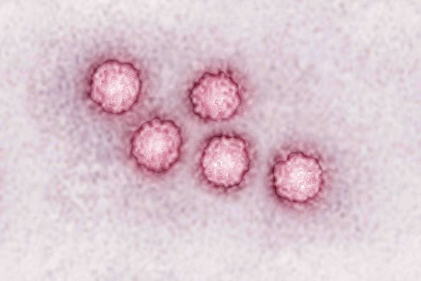 Virus de la hepatitis A.