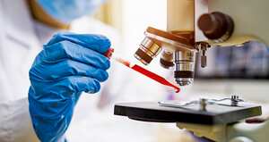 En Colombia, los casos de VIH vienen aumentando cada año. Mientras que en 2012 se presentaron 5.275, en 2023 esta cifra casi se triplicó hasta los 14.670 nuevos reportes.