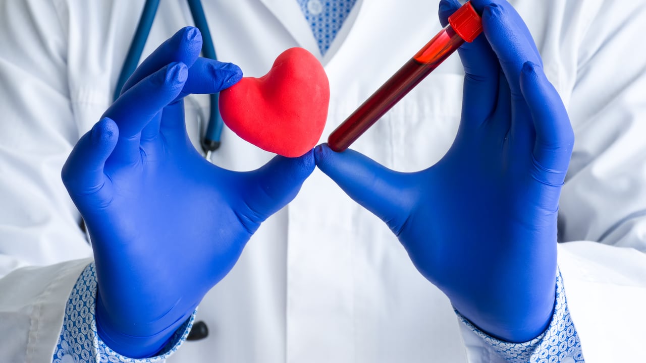 La prevalencia de colesterol alto en la población mundial ha generado una creciente preocupación sobre la necesidad de adoptar medidas preventivas efectivas.