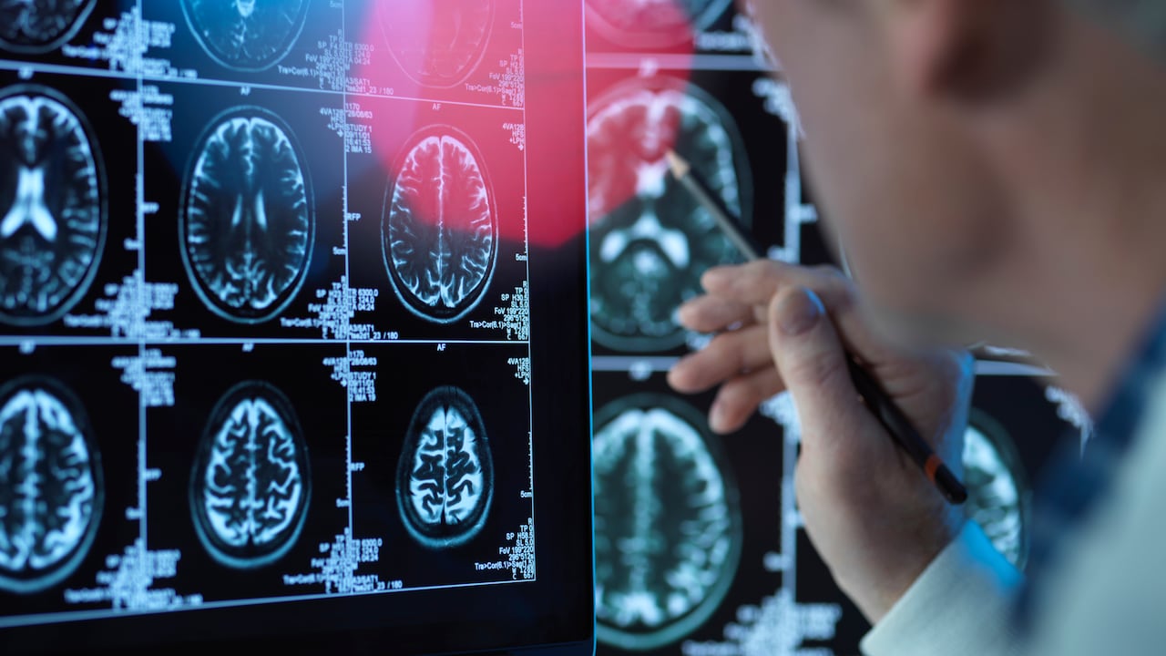 Doctor viendo escáneres cerebrales para posibles enfermedades o daños - Imagen de referencia