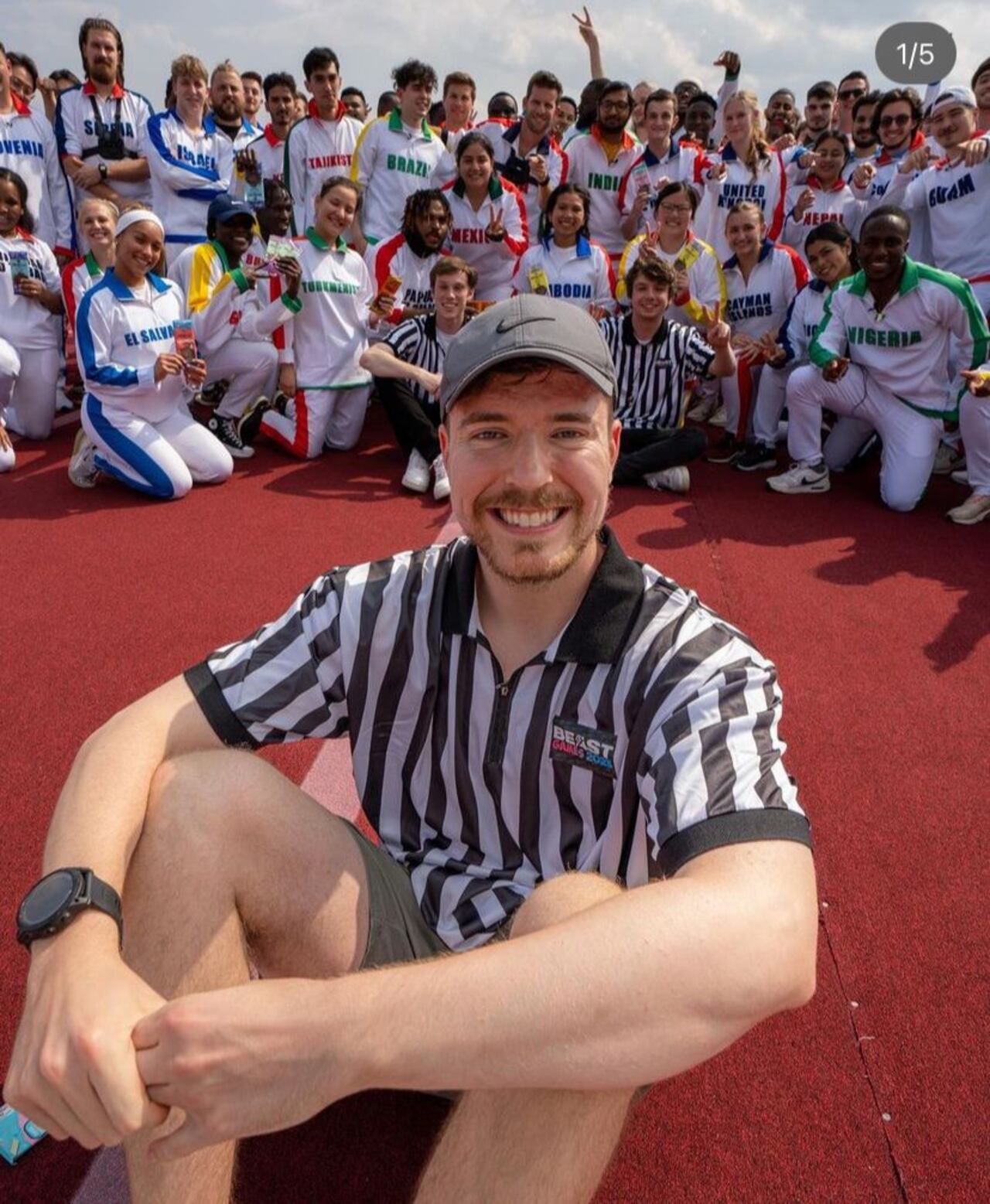 Por padecer Crohn, MrBeast no debe comer dulces ni comidas picantes.