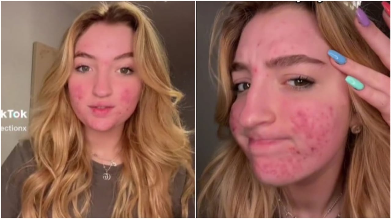 Un portavoz de TikTok le confirmó a BBC que la cuenta ya había sido regresada.