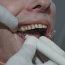 El sarro se produce por la acumulación de placa bacteriana.