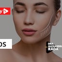 Los pómulos | Dra. Alexandra Rada en EstéticaMENTE