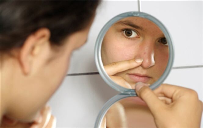 La ortiga puede ayudar a prevenir problemas de la piel como el acné. (Foto: Thinkstock) 