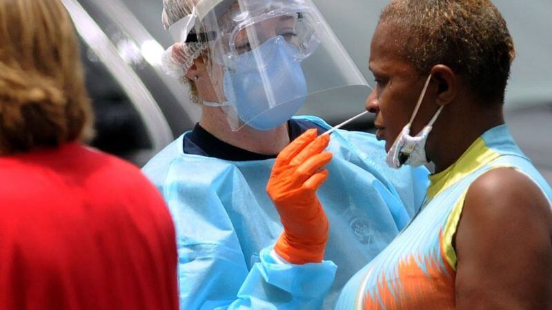 La población negra está siendo muy afectada por el coronavirus y hay que asegurarse de que reciban "los beneficios de las innovaciones que se están desarrollando", consideran los expertos.