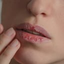 Enfermedad de la boca