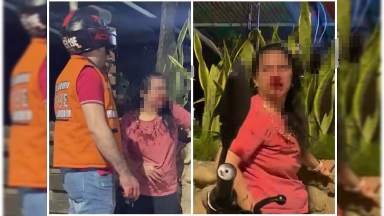 Al parecer, no sería la primera vez que este hombre agrede a su pareja sentimental.
