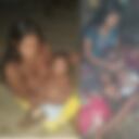 Niños víctimas de enfermedad diarreica aguda en Bajo Baudó, Chocó.