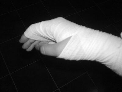 Menor falleció tras resultar quemado por accidente con una botella de gasolina en Codazzi, Cesar